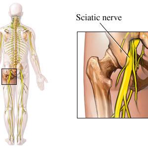 Yoga Sciatica Exercise - Does Sciatica Scare You? Do You Need To Be Scared, Find Out Here...