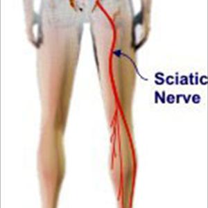 Sciatica Disease - Back Pain Relief Using The DRX9000 - No Inversion Table Hang Ups Here