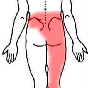 Exercise For Sciatica Back Pain - Sciatica Symptoms