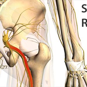 Sciatic Nerve Symptoms - Does Sciatica Scare You? Do You Need To Be Scared, Find Out Here...
